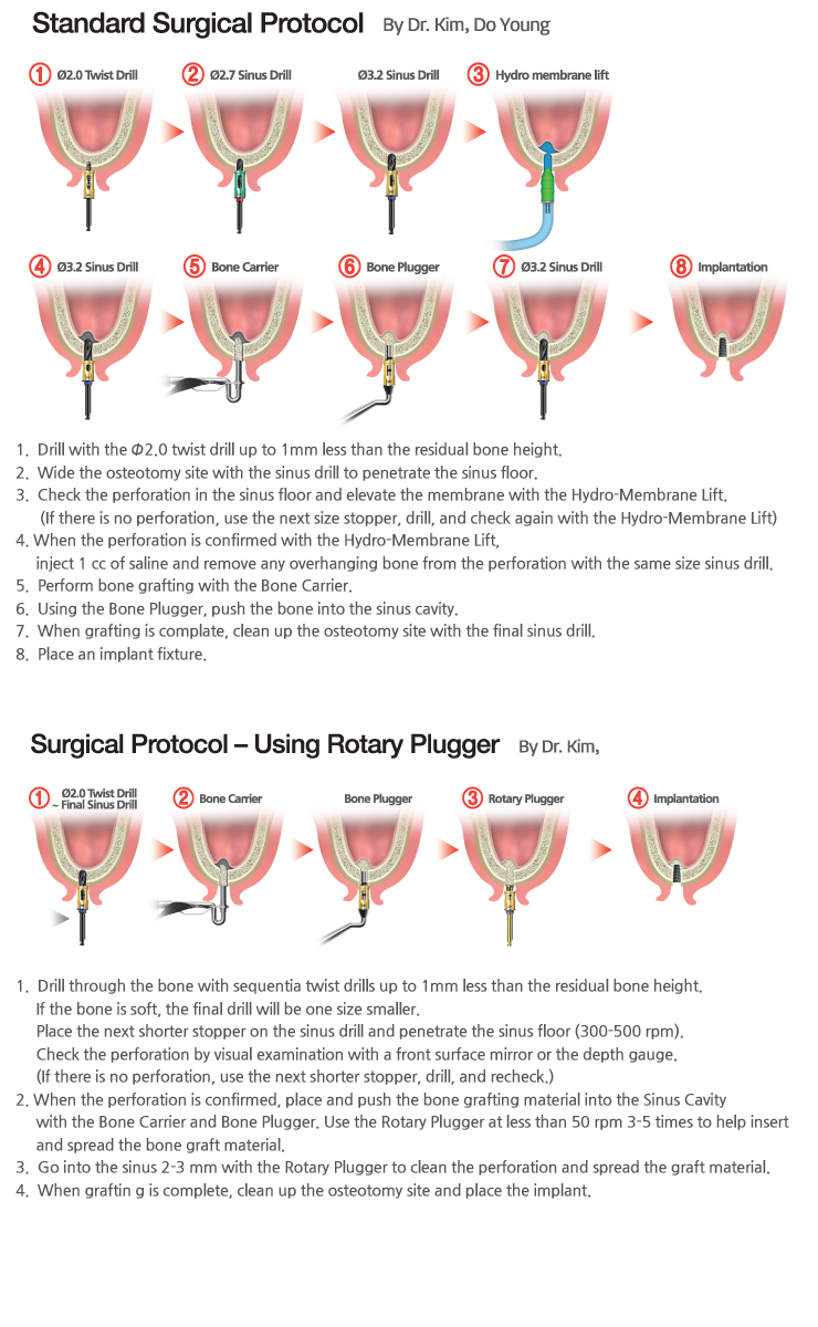 02_sinusKit_surgical.jpg